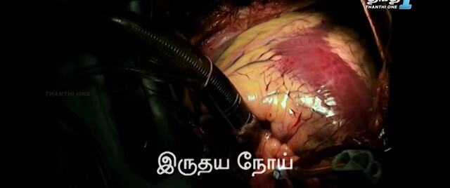 Moviesda.Mobi - Yegathipathi 2024 Original 720p HD (700MB)